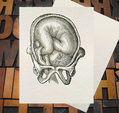 Letterpress Card with an anatomical image of a baby being born