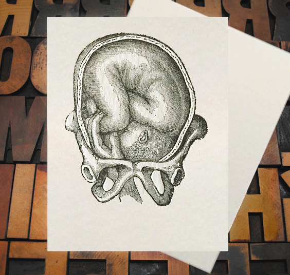 Letterpress Card with an anatomical image of a baby being born