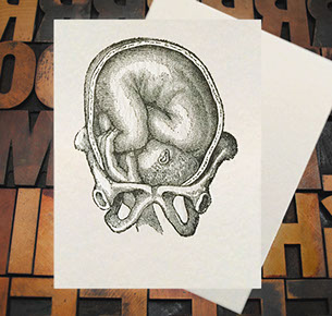 Letterpress Card with an anatomical image of a baby being born